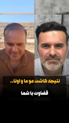 مطلب نمونه شماره1